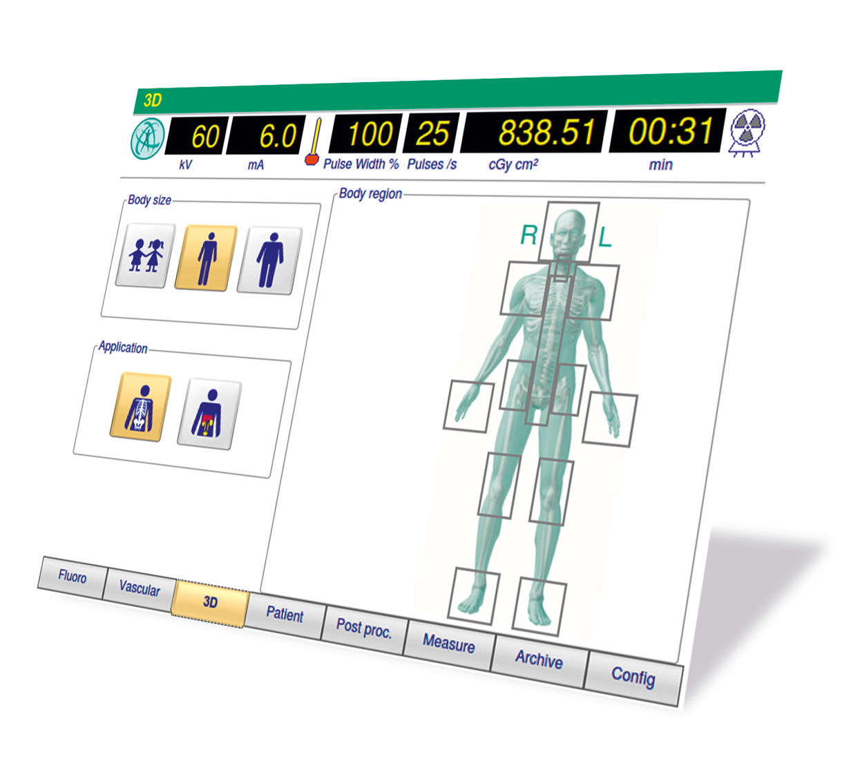 Ziehm 3d mobile c-arm user interface