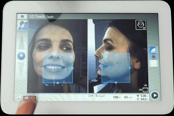 Animation of Planmeca Viso’s control panel utilising integrated cameras and a live patient view