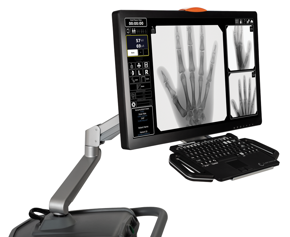 TAU CMOS Screen monitor