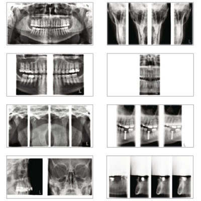 planmeca-promax-2d-unit-imaging-programs