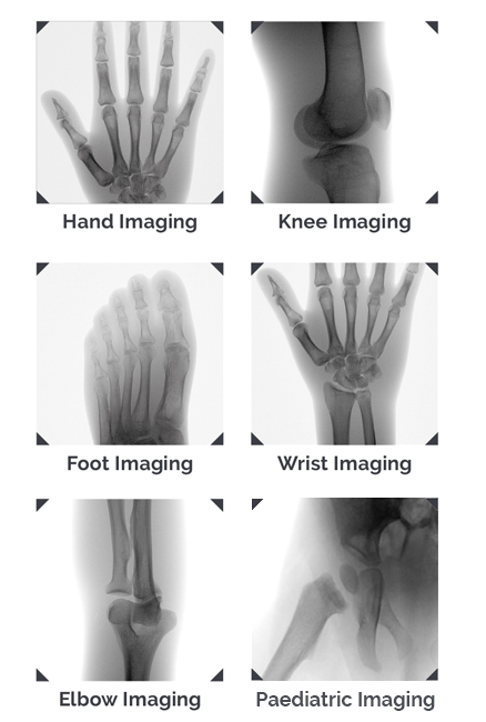 TAU examples X-ray of Hand, Knee, FOot, Wrist, Elbow and Paediatric imaging