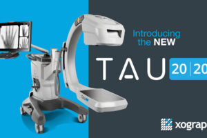 Introducing TAU 2020; the new benchmark in low dose extremity imaging.